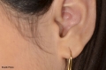 Furuncle Of Ear