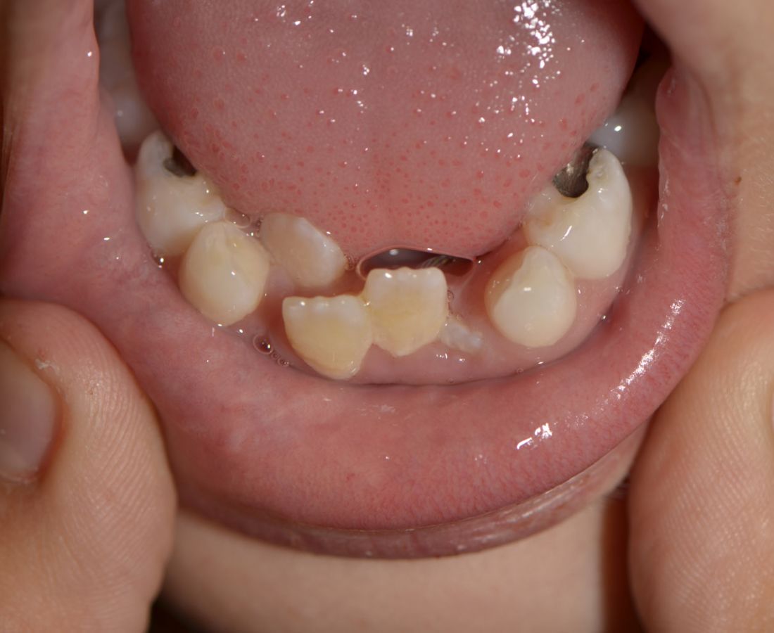 صور طبية – ألبوم صور  : تشوّهات الأسنان2